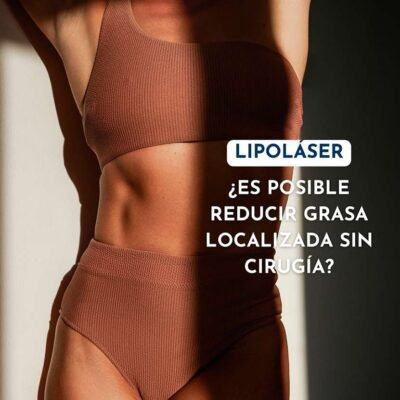 7 Preguntas Frecuentes sobre Liposucción Sin Cirugía